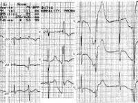 IpVw@9鵴櫕澱修q?T練@縺?8?蘄=覙)?簂!C?fс螘塣-?k[2媼W?榃瑵?i?諘?'?紓|(鏞?)?鍴?8??膃{f黼的简单介绍-im电竞中国官网